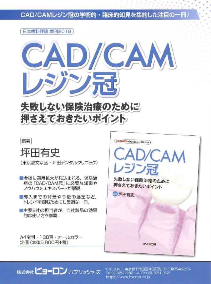 CAD/CAMレジン冠