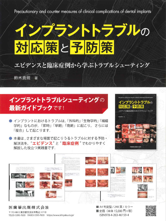 書籍詳細「インプラントトラブルの対応策と予防策」 | フォルディネット