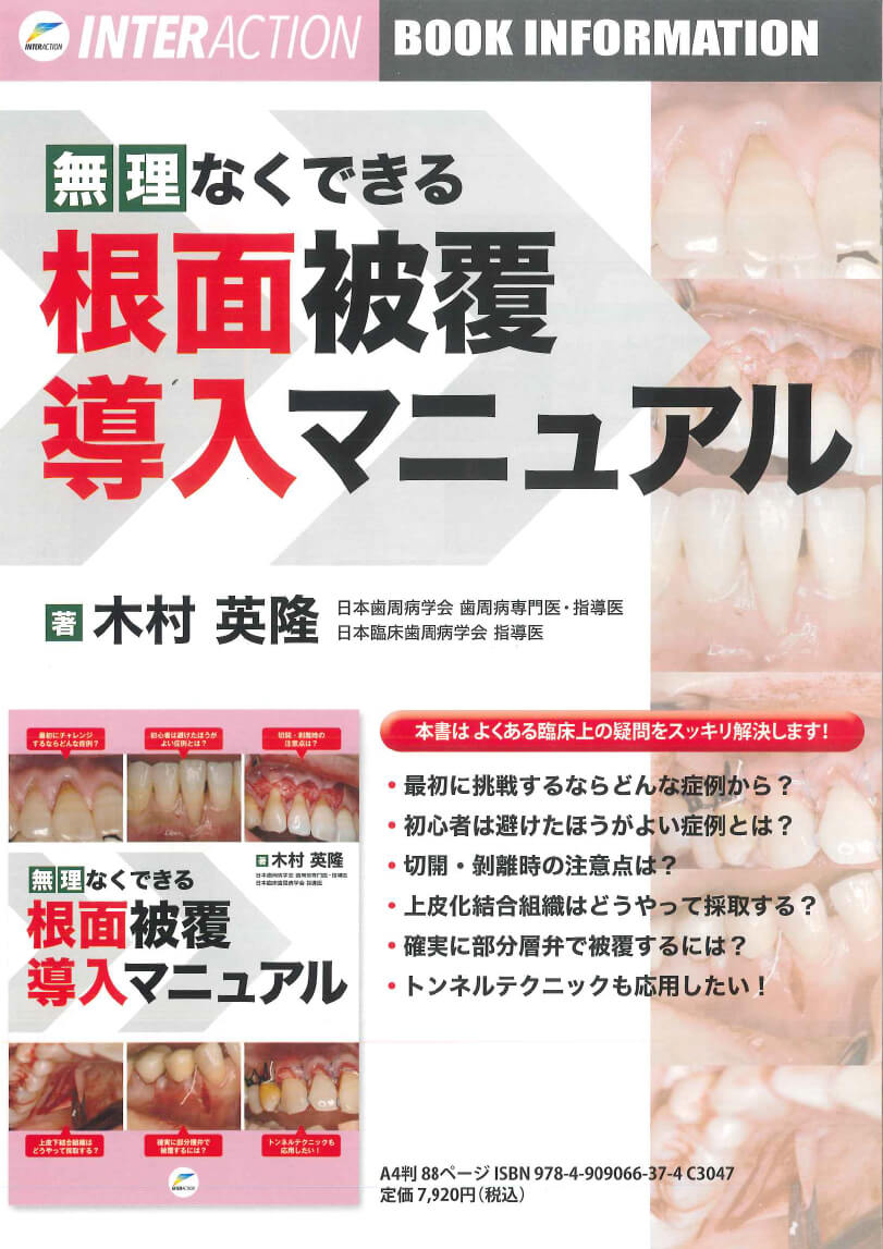 書籍詳細「無理なくできる外科的根管治療導入マニュアル」 | フォル 