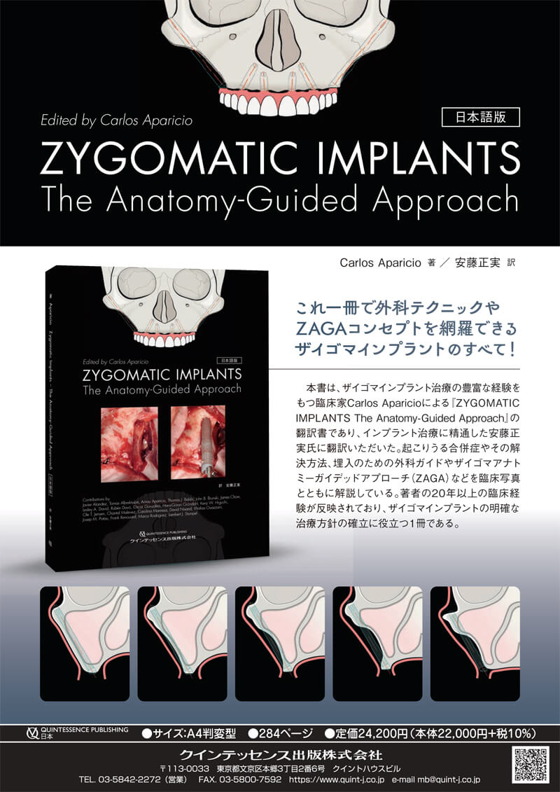 ZYGOMATIC IMPLANTS<日本語版>