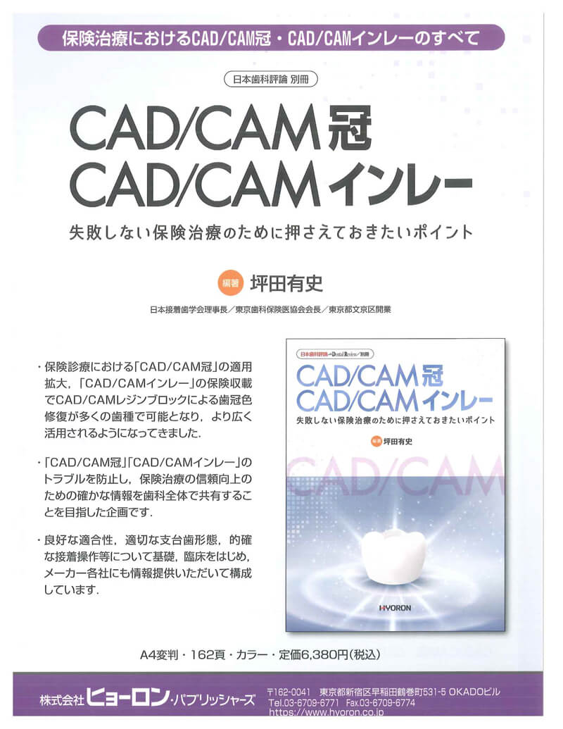 CAD/CAM冠 CAD/CAMインレー