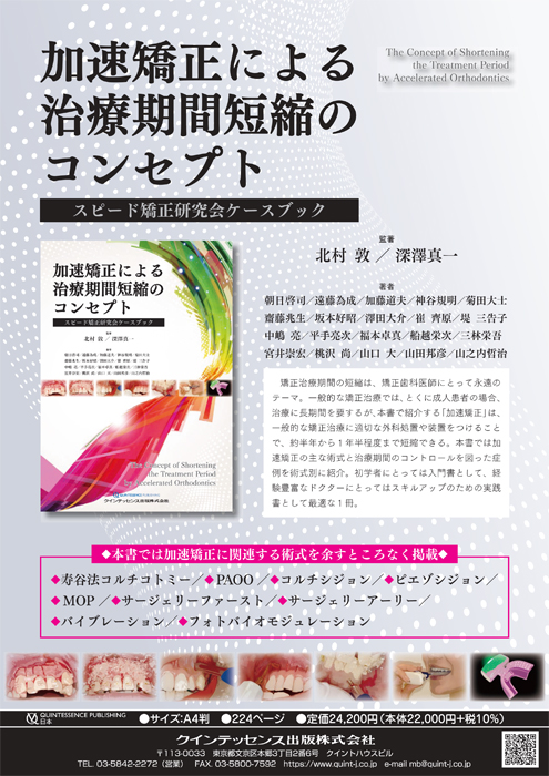 加速矯正による 治療期間短縮のコンセプト