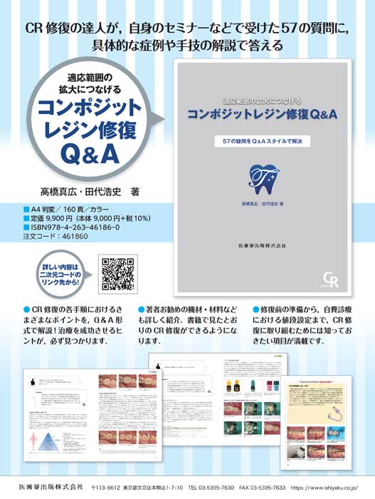 コンポジット レジン修復 Q＆A