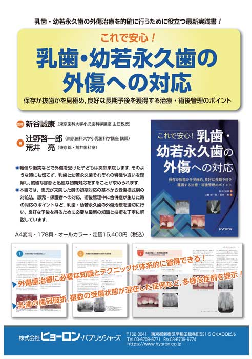 これで安心！　乳歯・幼若永久歯の外傷への対応