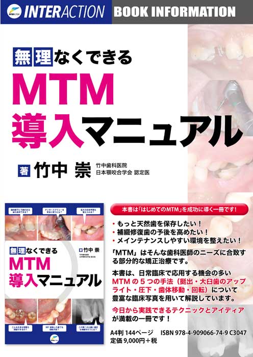 無理なくできるMTM導入マニュアル