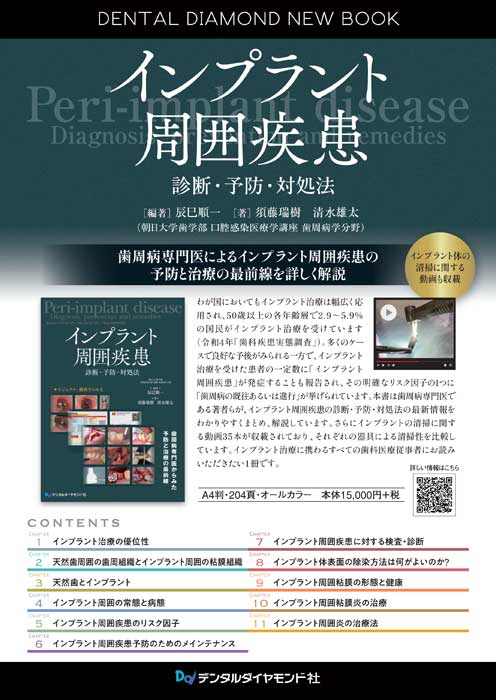 インプラント周囲疾患