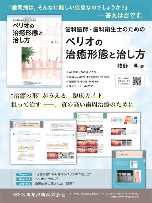 ペリオの治癒形態と治し方