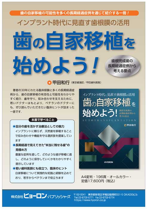 歯の自家移植を始めよう！