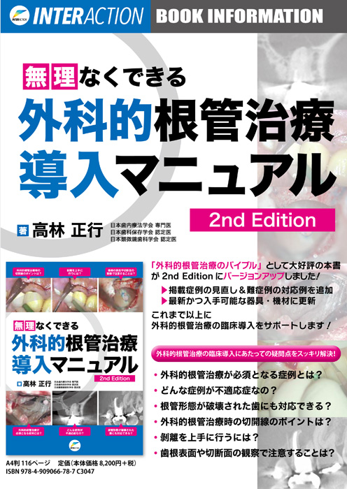 無理なくできる外科的根管治療導入マニュアル　〈第2版〉