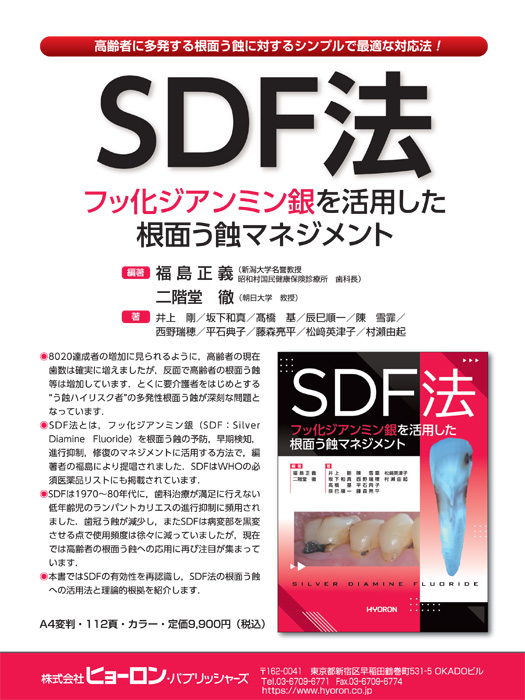 SDF法