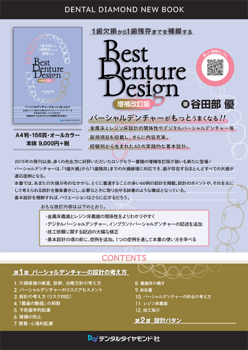 Best Denture Design