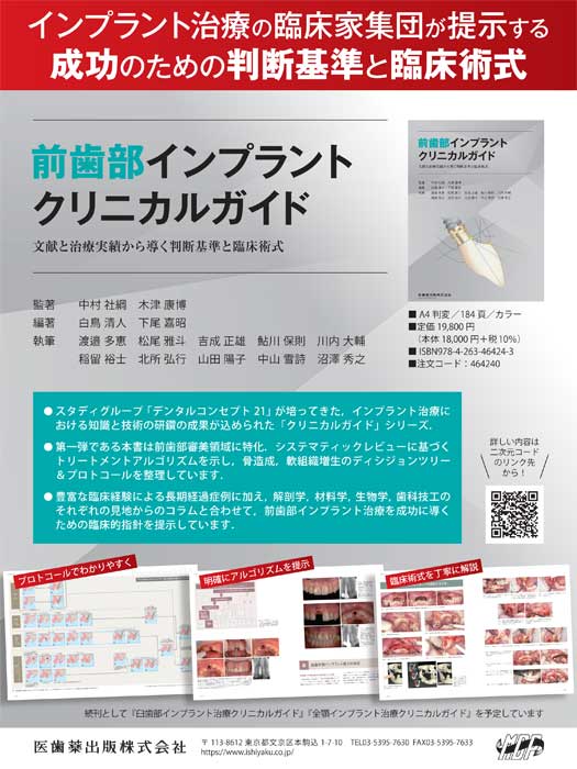 前歯部インプラント クリニカルガイド