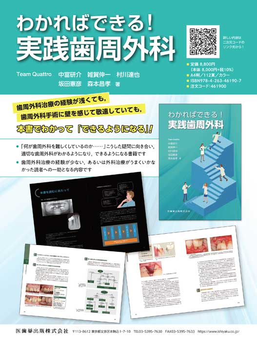 わかればできる！実践歯周外科