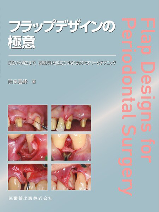 フラップデザインの極意