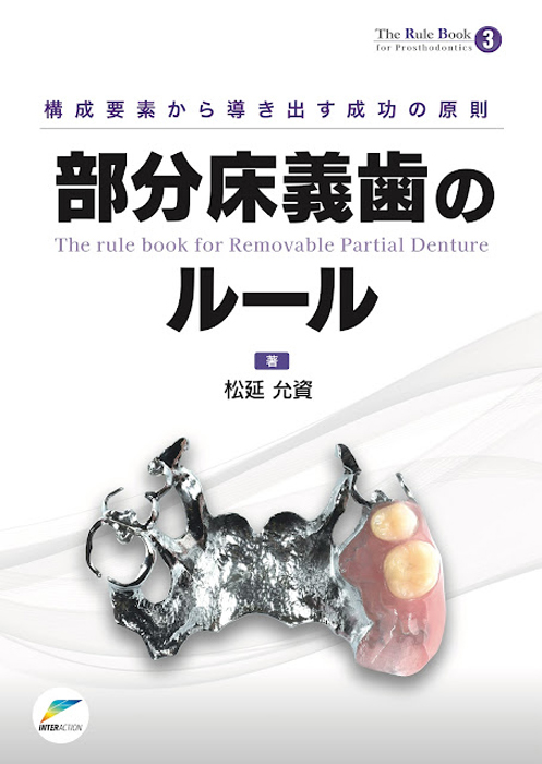 部分床義歯のルール