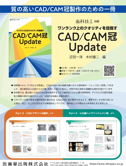 CAD/CAM冠 Update