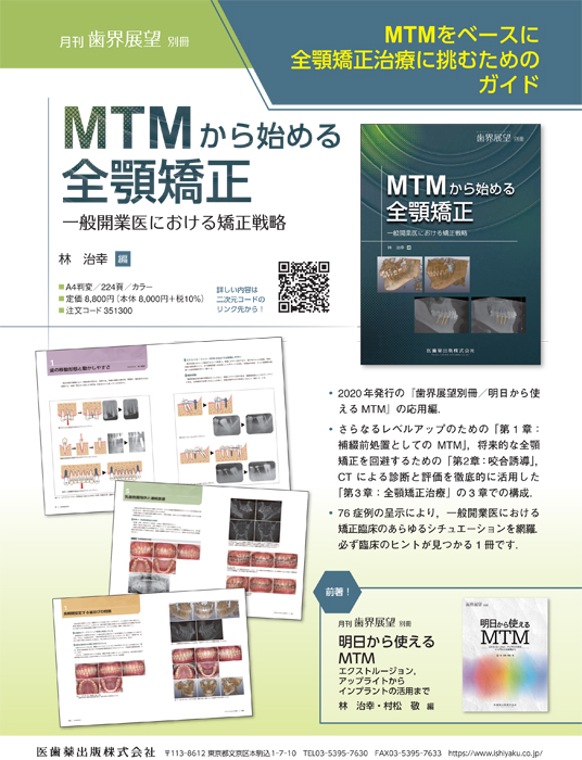 MTMから始める全顎矯正