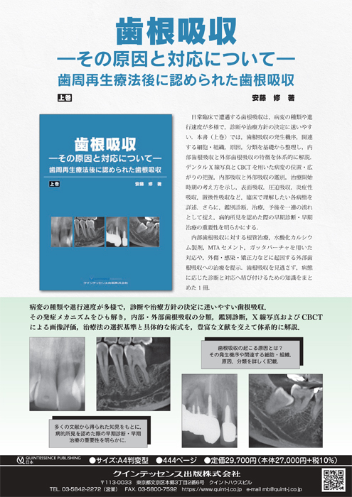 歯根吸収　その原因と対応について（上巻）