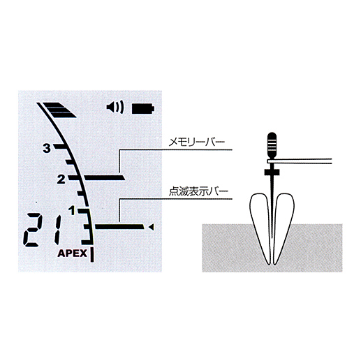 モリタ ルートZX mini レッド 品 歯科用根管長測定器 - オーラルケア