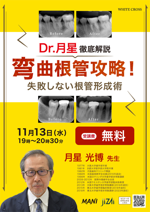 Dr.月星 徹底解説 湾曲根管攻略！